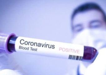 Рекомендації для осіб, з підозрою або хворими на COVID-19, які перебувають вдома на самоізоляції